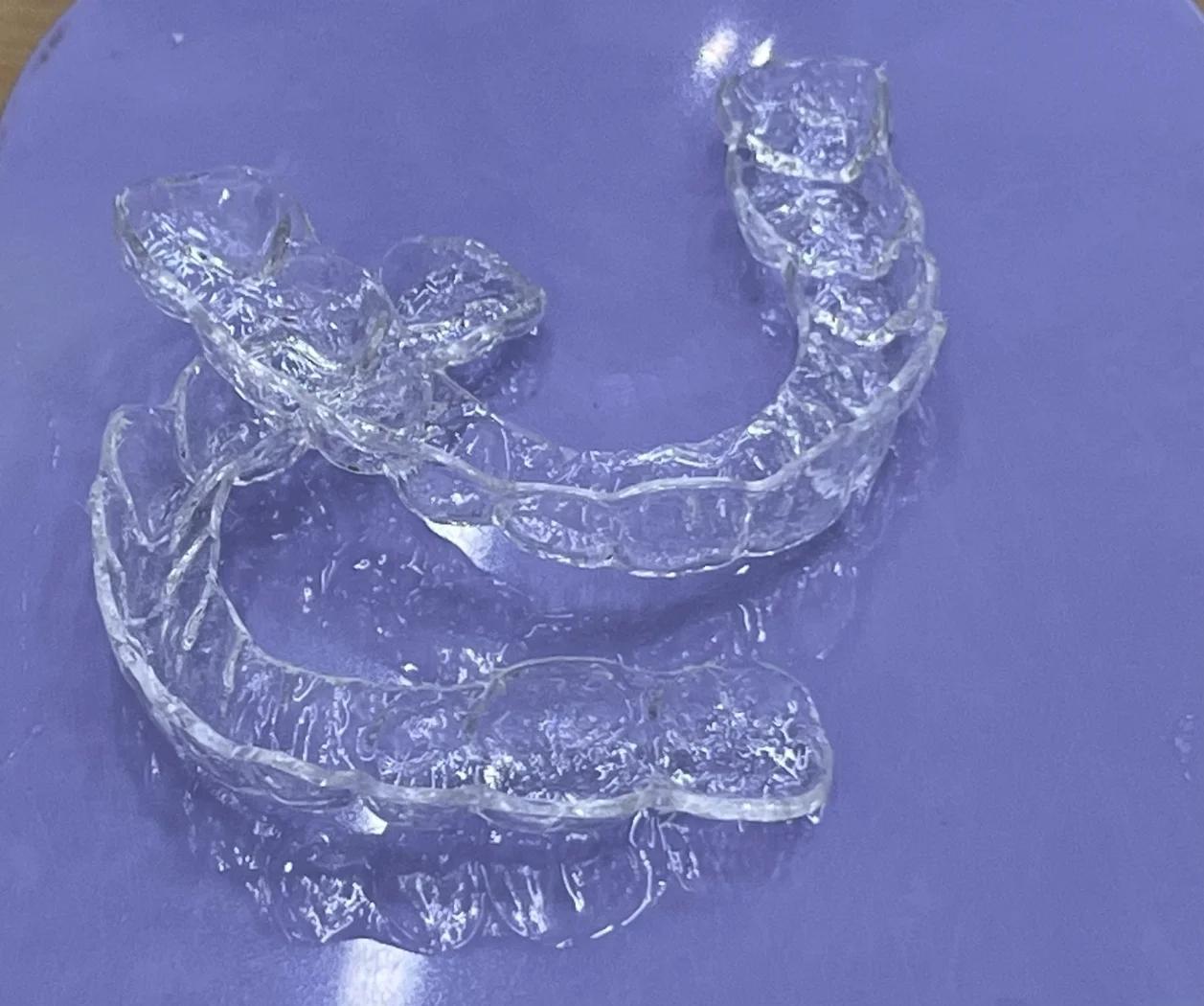 我戴保持器,但同时是篮球爱好者。